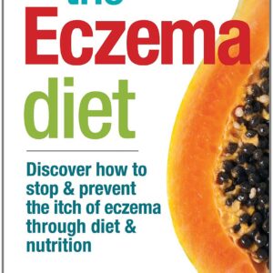 The Eczema Diet: Discover How to Stop and Prevent The Itch of Eczema Through Diet and Nutrition
